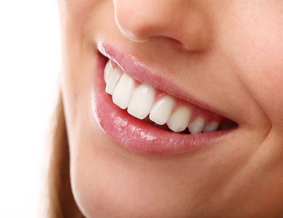 Chestermere Teeth Whitening | Cosmetic Dentistry | Chestermere Dental