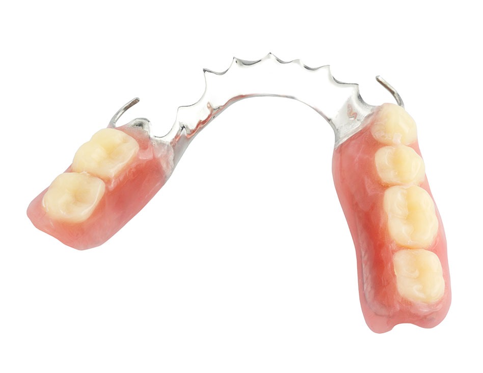 What are the benefits of partial dentures | Chestermere Dental | General Dentistry