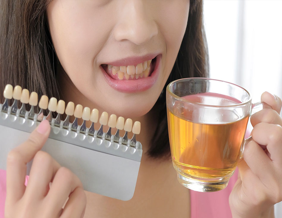 What Causes Teeth Stains | Teeth Whitening & Cosmetic Dentistry | Chestermere Dental