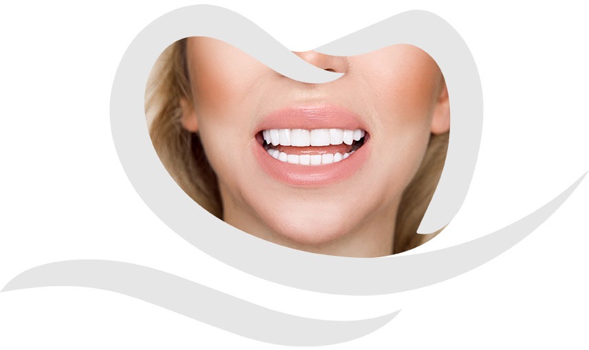 Chestermere Porcelain Veneers | Cosmetic Dentistry | Chestermere Dental