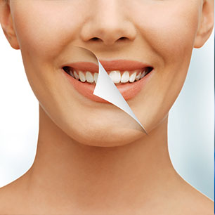 Teeth Whitening Cosmetic Dentistry | Chestermere Dental | Family Dentist Chestermere AB