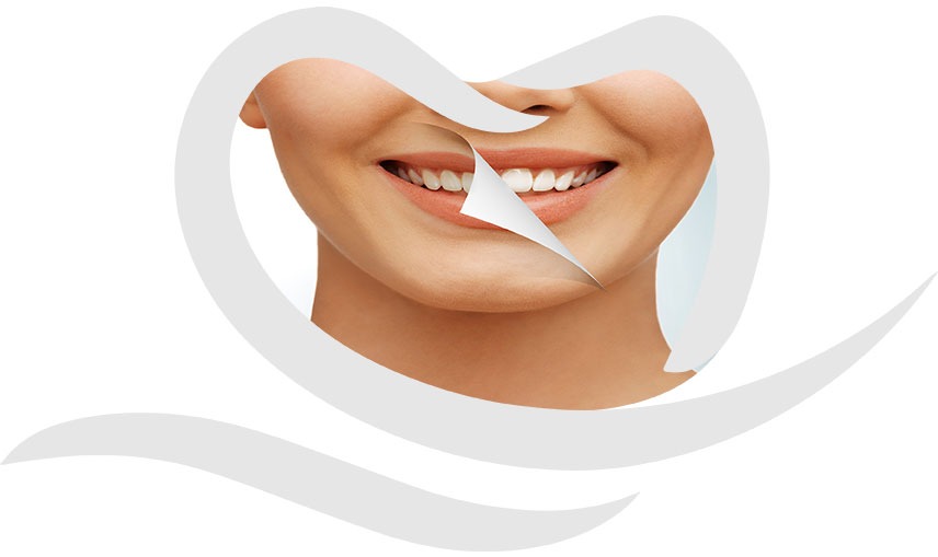 Teeth Whitening Dentistry | Chestermere Dental | General and Family Dentist Chestermere AB